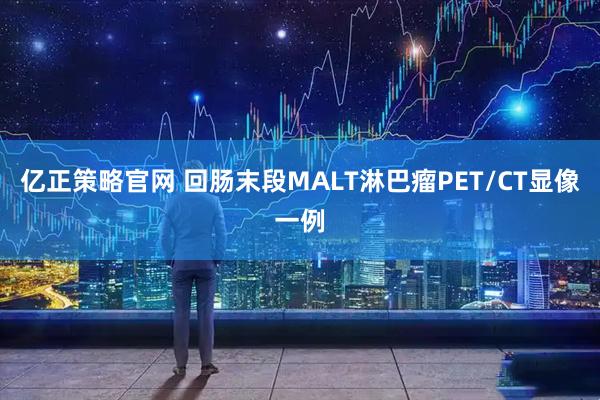 亿正策略官网 回肠末段MALT淋巴瘤PET/CT显像一例